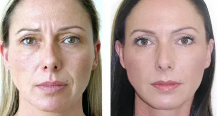 How to Make Natural Face Masks for All Skin Types How to Make Natural Face Masks for All Skin Types