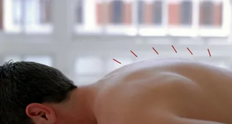 Healthy Lifestyle - Your Natural Health - How Acupuncture Can Improve Your Health and Balance Energies 