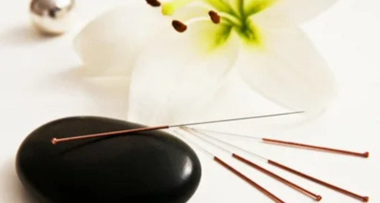 Healthy Lifestyle - Your Natural Health - How Acupuncture Can Improve Your Health and Balance Energies 